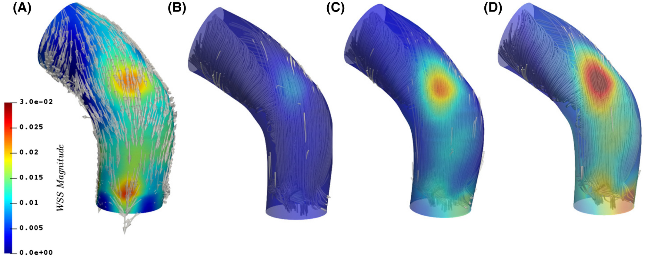 Magnitude of wall shear stress from the posterior view obtained A, from DNS complemented with the arrow representation of the WSS vector at the aorta wall; B, from MRI data using the direct and formal definition of WSS; C, using the first model M1 for the evaluation from MRI measurements; D, using the second model M2 for the MRI-based assessment.