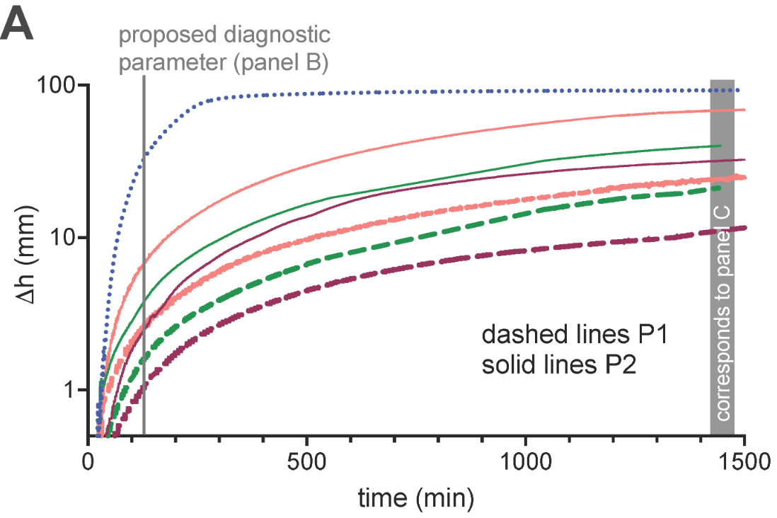 Measurements of the ESR with the standard Westergren method using EDTA blood. (A) Plots of the color-coded sedimentation curves retrieved from optical images taken every minute, i.e., the density of the data points corresponds approximately to the printed resolution.